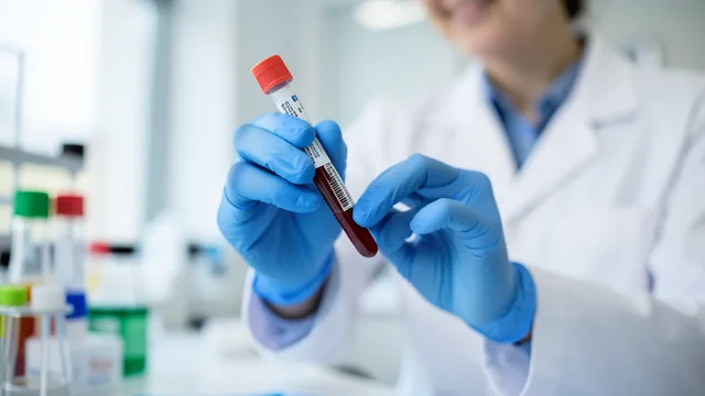 Imagem gerada por IA: Tubo de amostra de sangue em um laboratório clínico moderno.